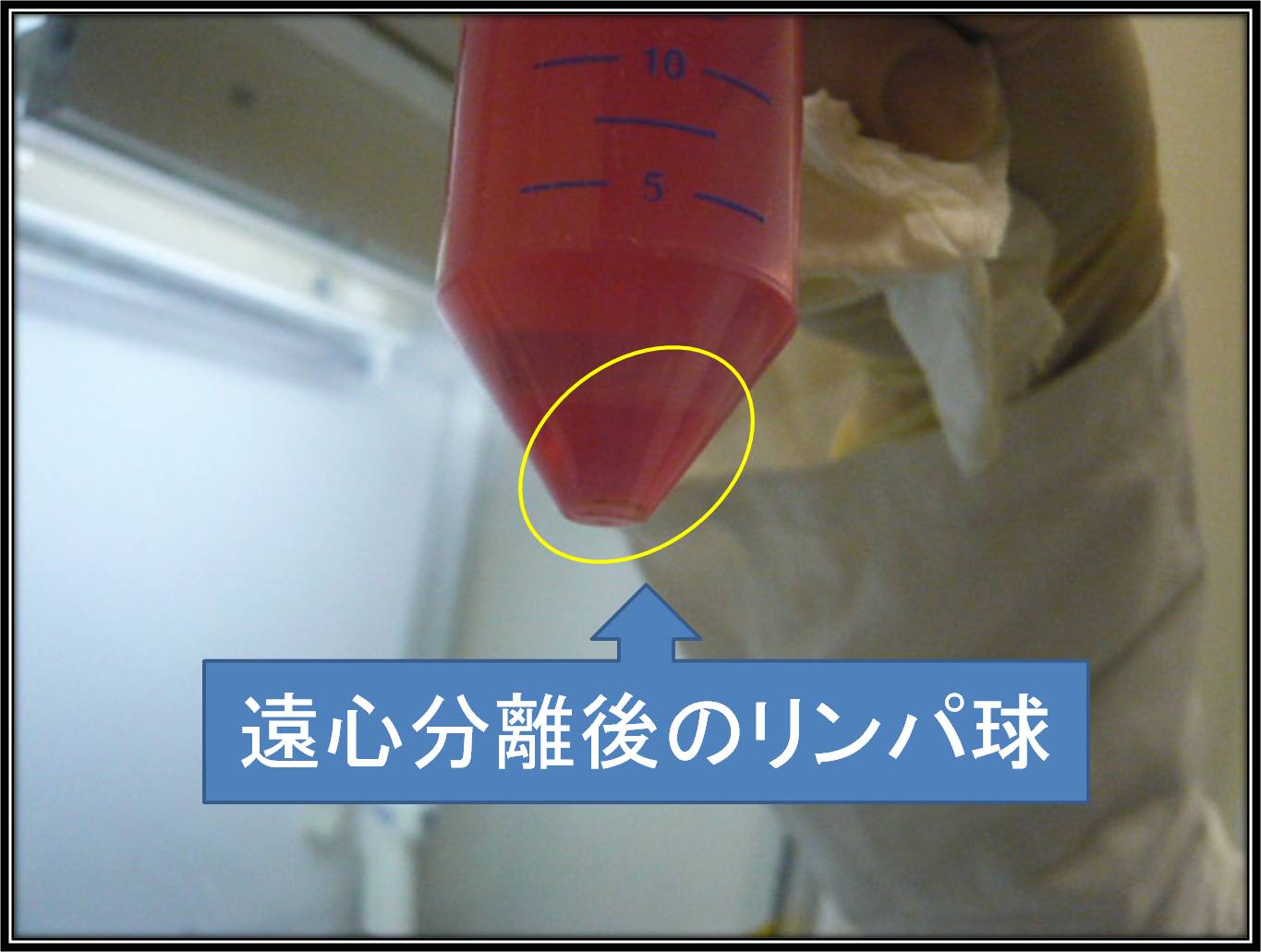 リンパ球回収・製剤化