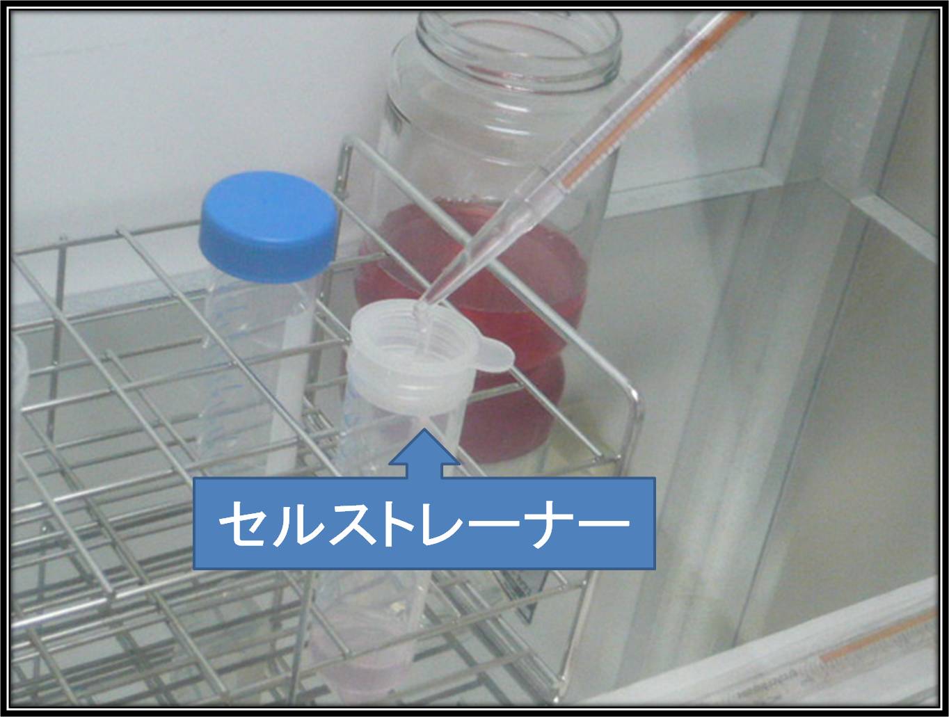 リンパ球回収・製剤化