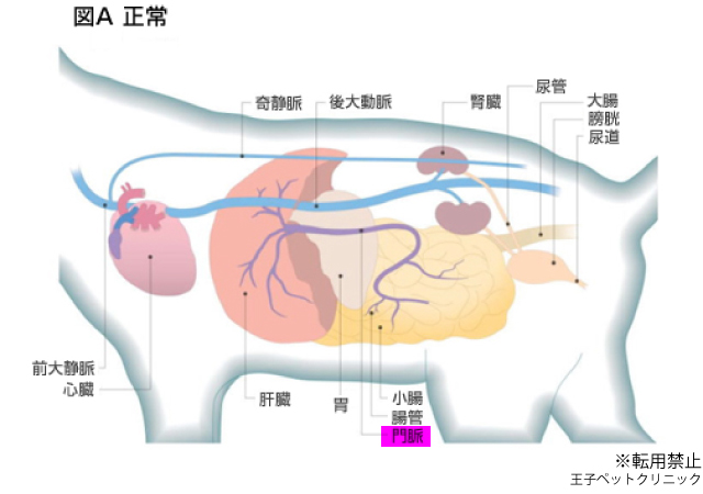 門脈シャント