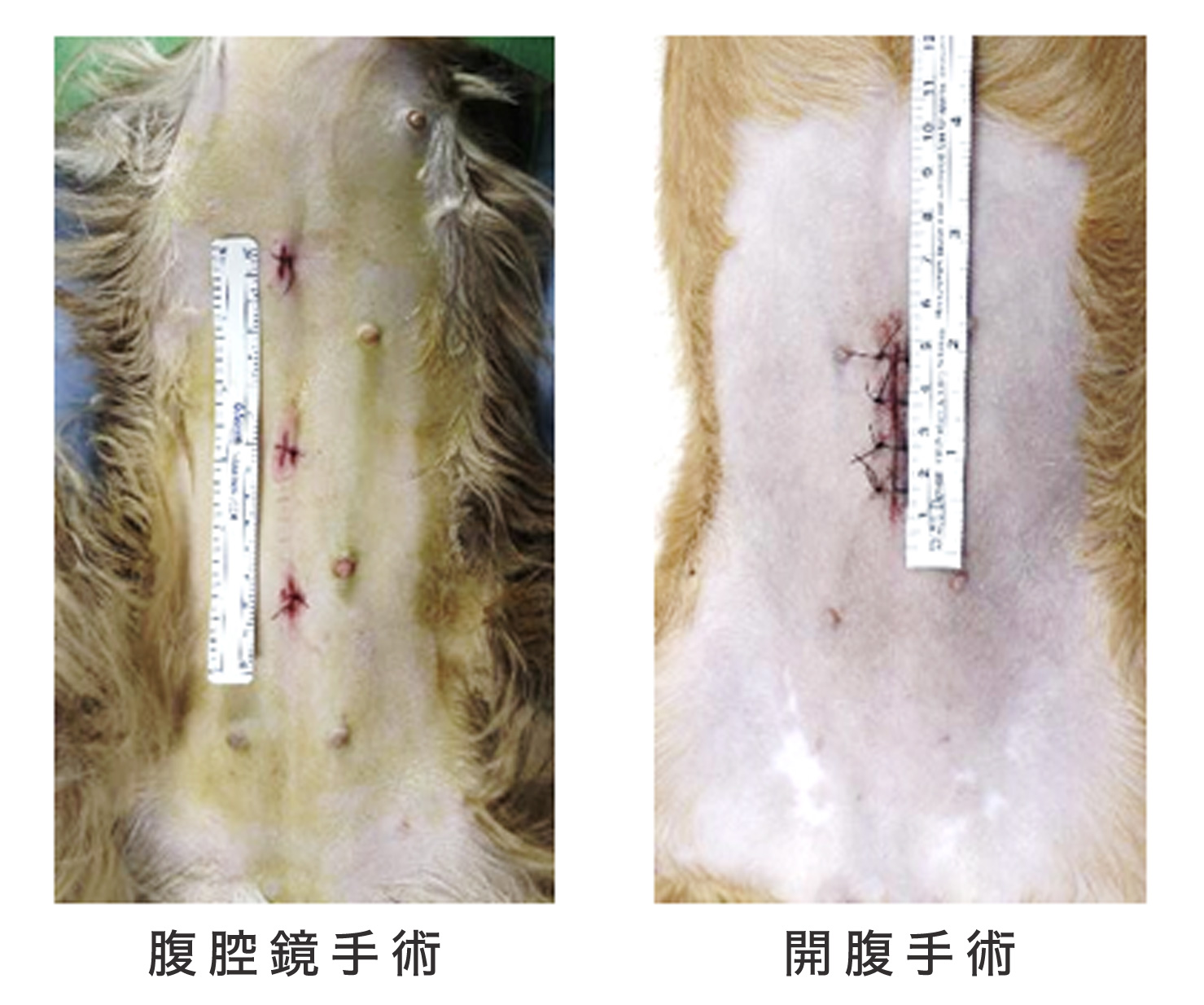 腹腔鏡下避妊手術