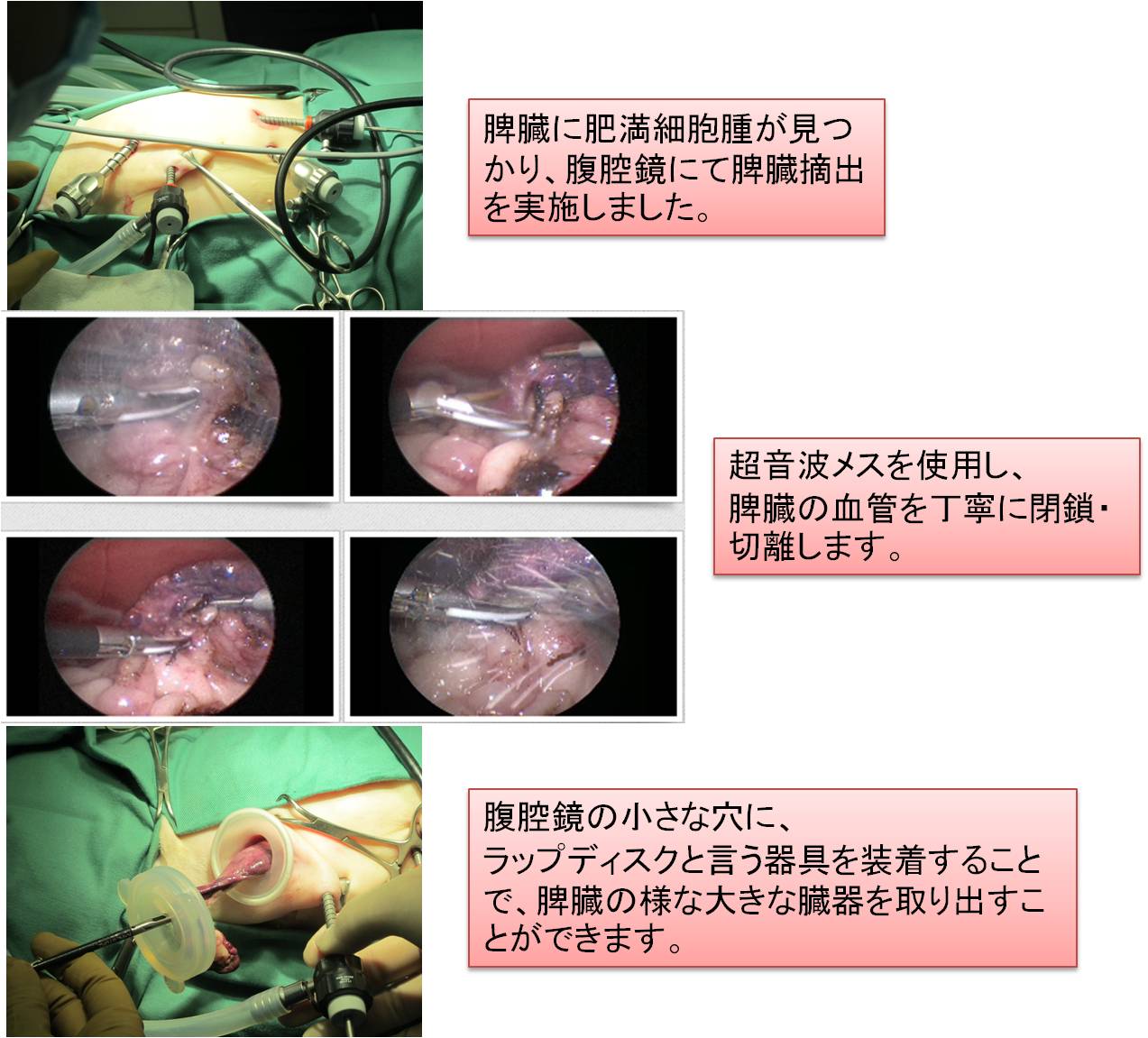 脾臓摘出術 東京都北区の動物病院 王子ペットクリニック