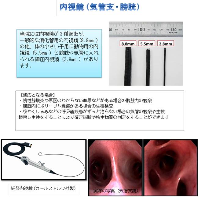 気管支鏡検査