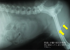 電気水圧衝撃波結石破砕術（EHL）