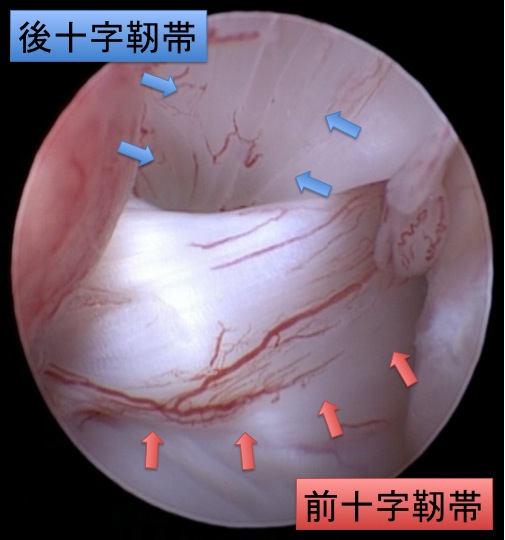 関節鏡検査