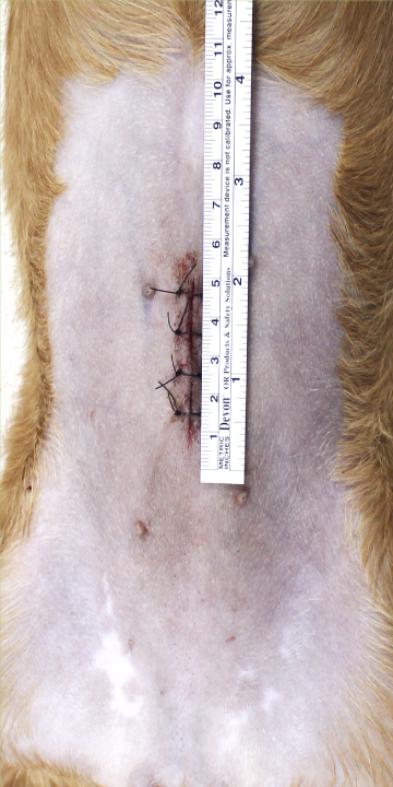 腹腔鏡下避妊手術