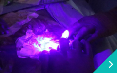 新しい腫瘍外科手術